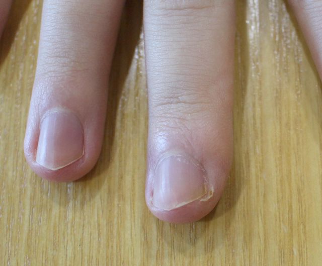 26세 남성 · 7개월 경과